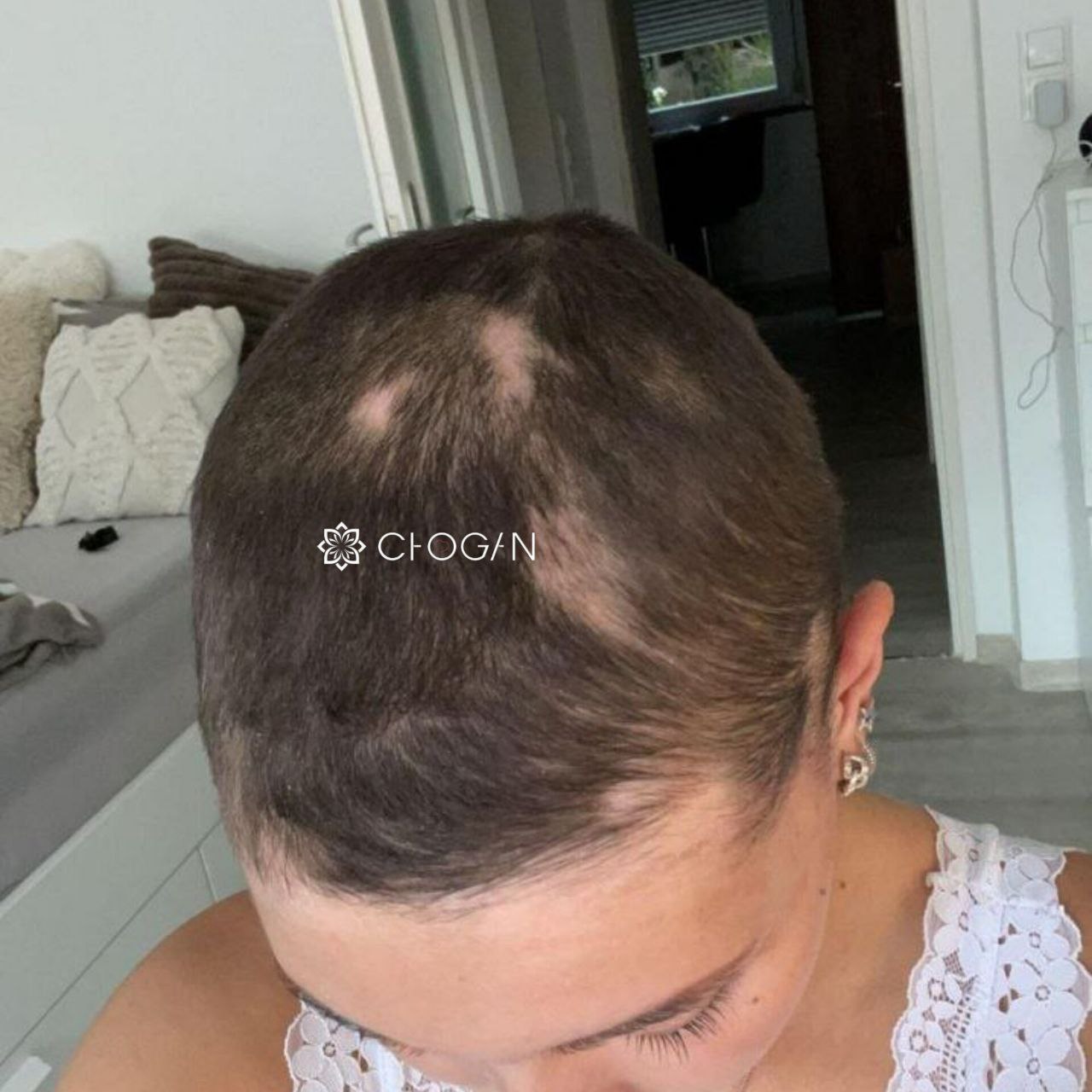 Capillaire Compléte avant après chute heveux JMBL chogan -  JosMir Beauty & Luxury