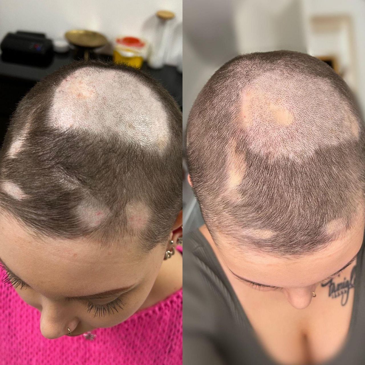 Capillaire Compléte avant après chute heveux JMBL chogan -  JosMir Beauty & Luxury