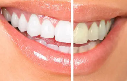 Duo dents blanches - N° JMBL003 - JosMir Beauty & Luxury