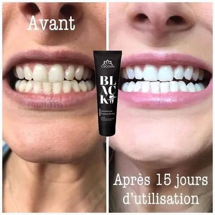 Shampoing au charbon actif - N° BLK03 -  JosMir Beauty & Luxury