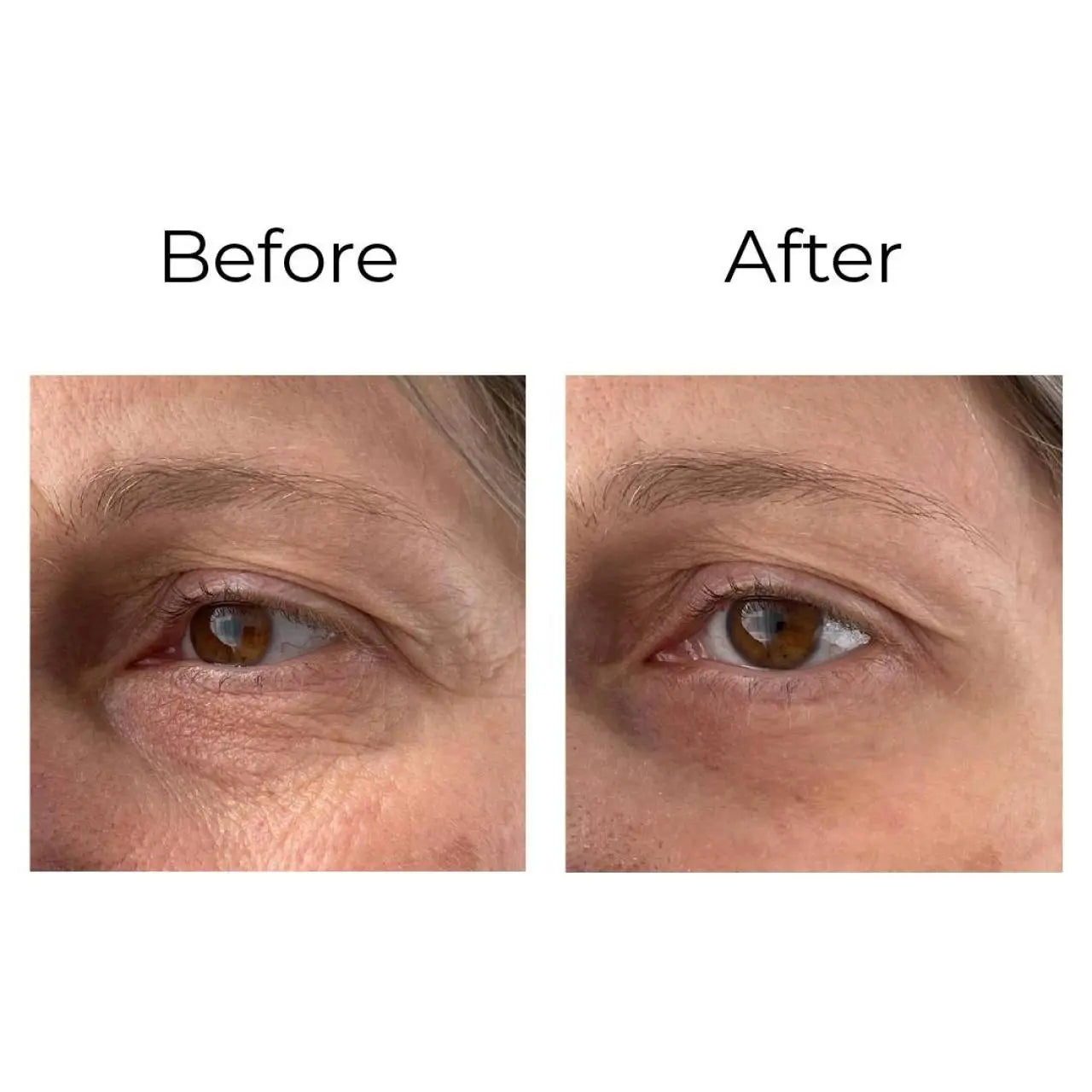 Peptilux - Crème anti-rides pour les yeux à effet « shock action » avec LIPHASYN - N° LUX001 - JosMir Beauty & Luxury